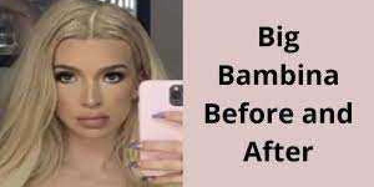 Article Picture