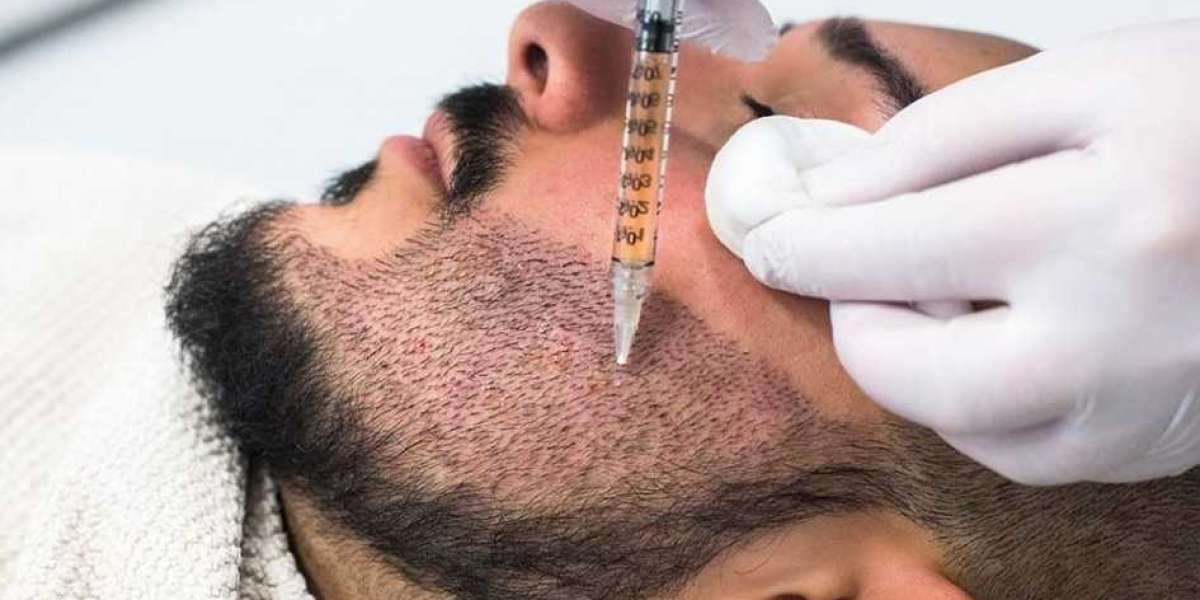 Resultados del trasplante de barba